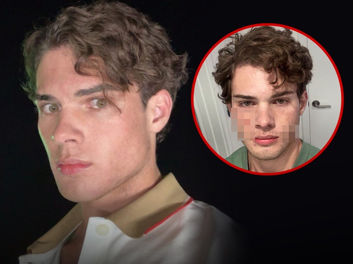 clavicular injury insta 1