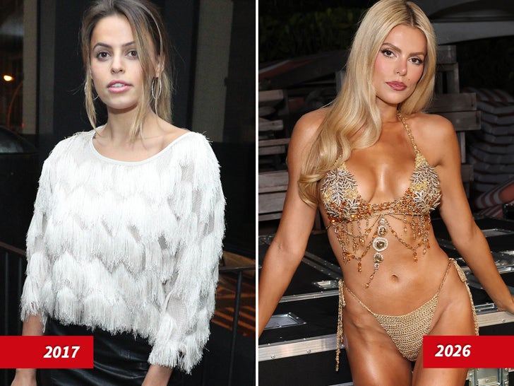Brooks Nader Then And Now -- Good Genes or Good Docs?!