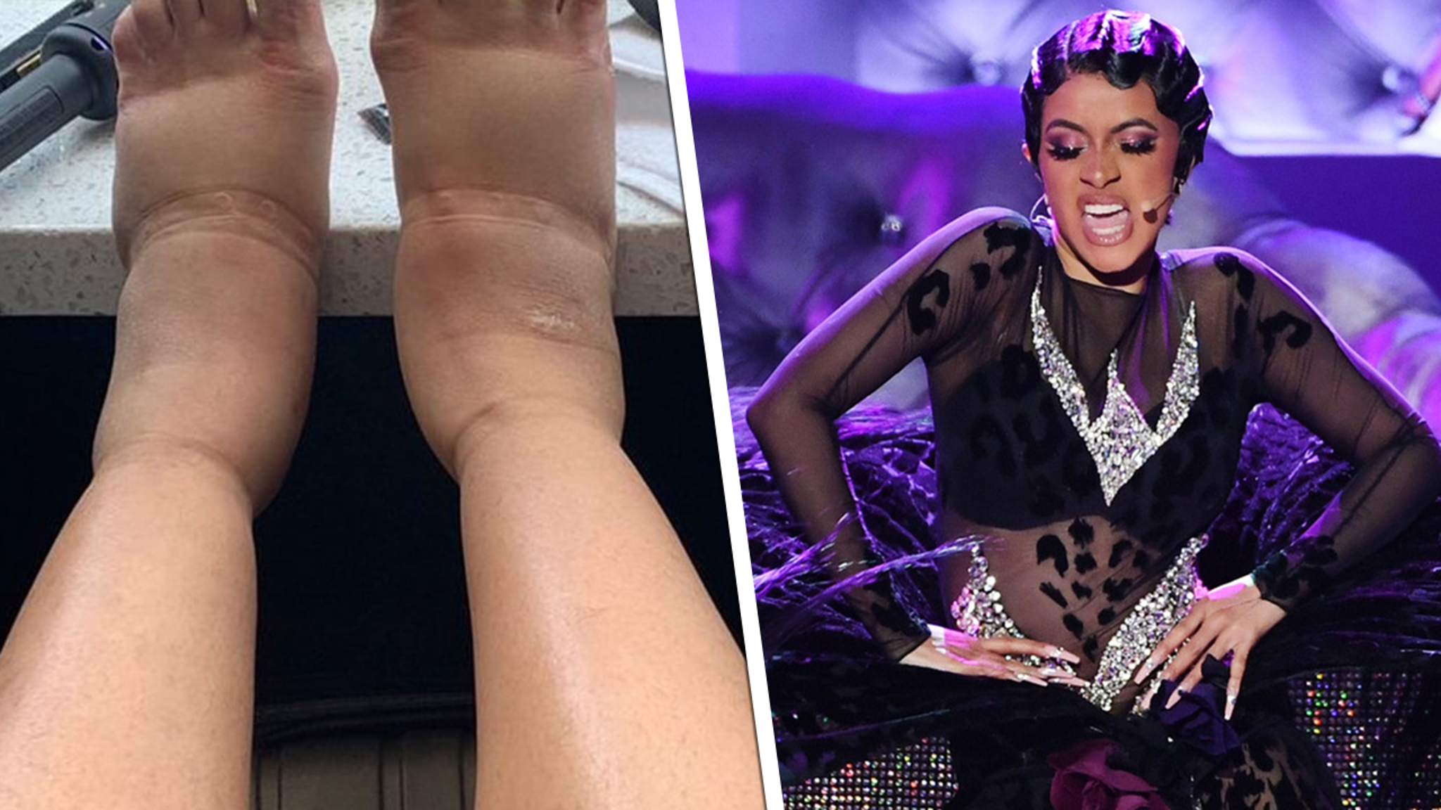Cardi B's Feet Are Swollen And Terrifying.