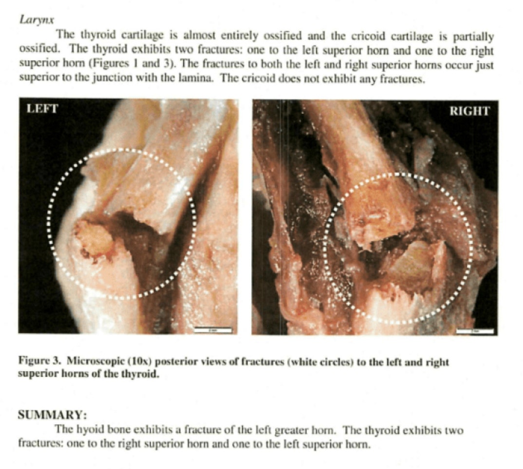 Jeffrey Epstein Death Investigation Photos 17
