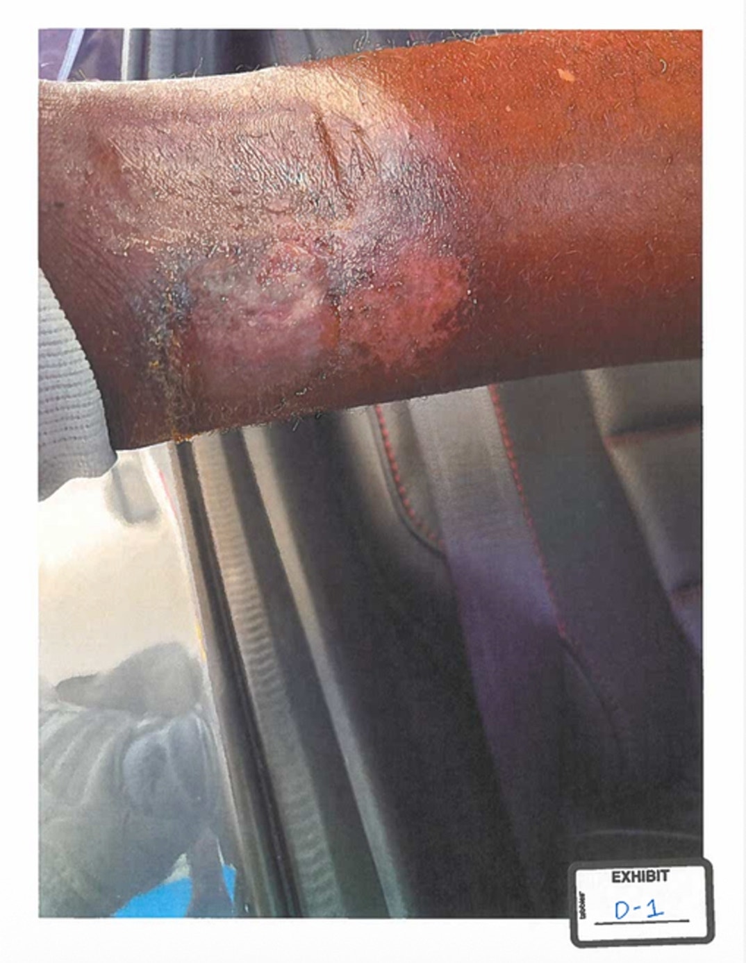 Patrick Mahomes Sr. Injury Pics 1