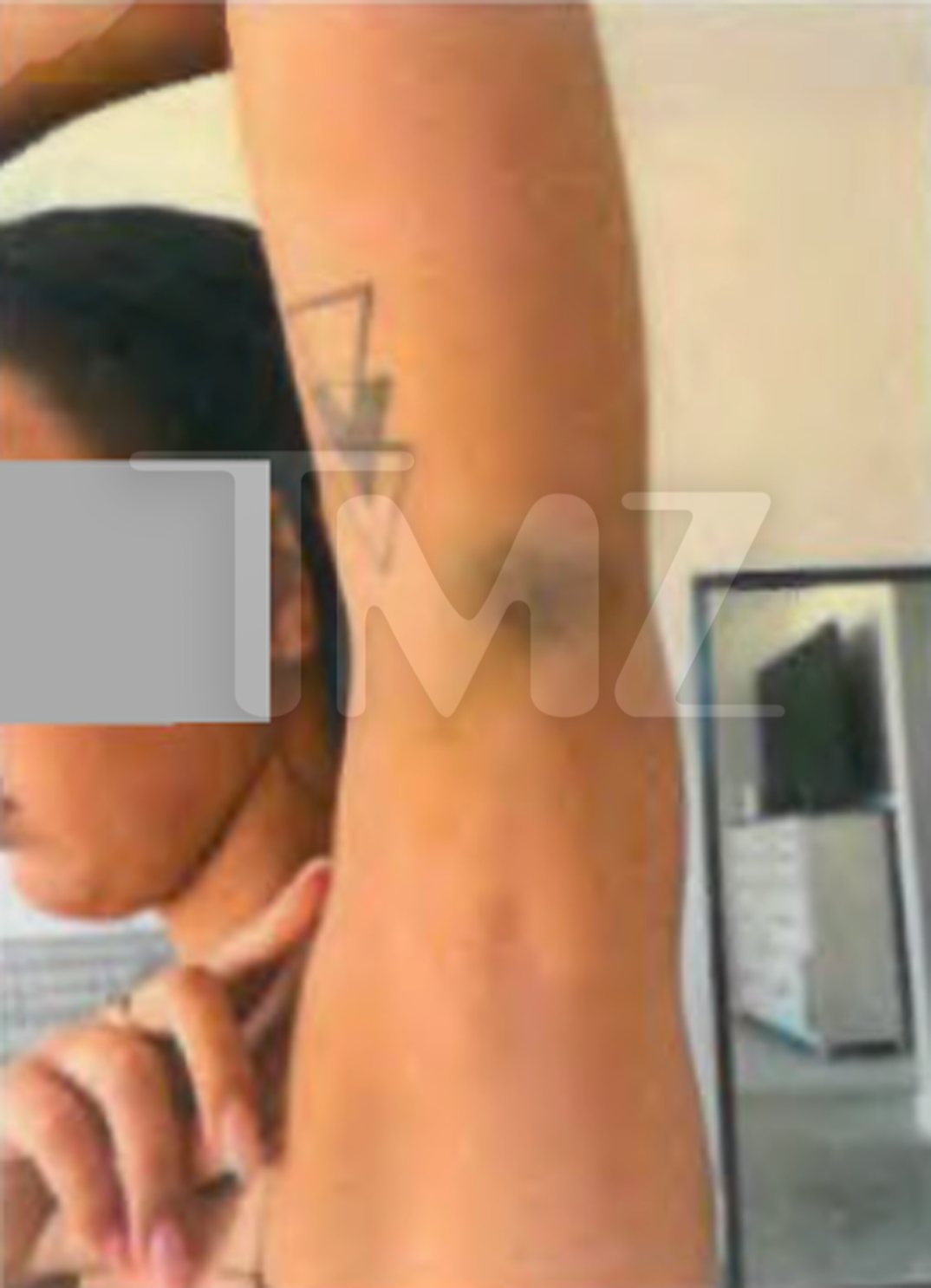 Maria Lafuente Injuries 5