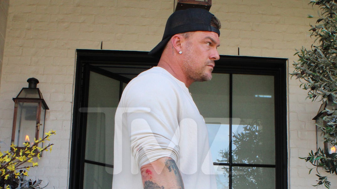 0416-Alan-Ritchson-Injury-Photos-PRIMARY