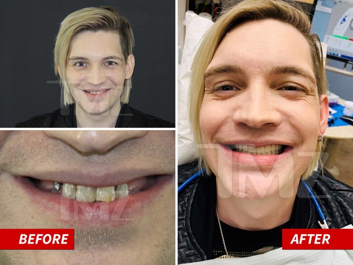 Alex Band -- The Mouth Makeover