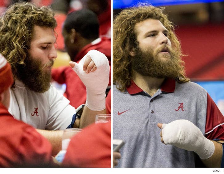 Alabama Football Player Blew Off Finger with Shotgun :: 1229-dakota-ball-al-4