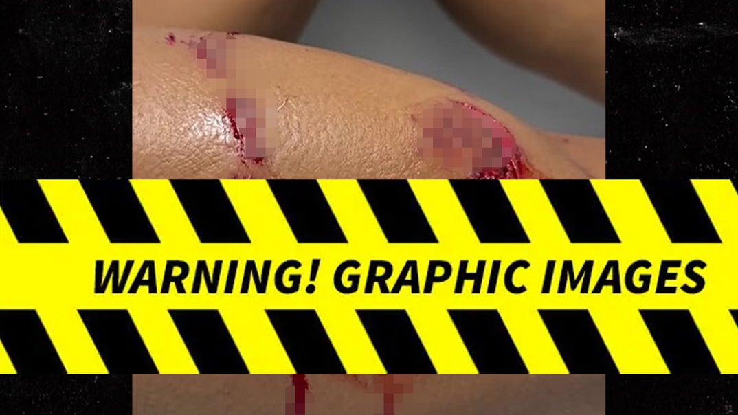 0112-0112-Lawyer-Tayane-Dalazen-Shark-Attack-PRIMARY