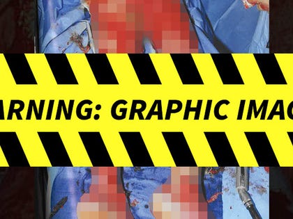 1020_primary_travis_barker_burn_photos_launch