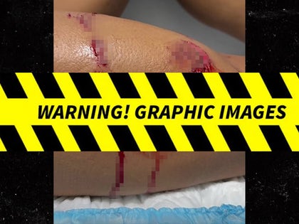 0112-0112-Lawyer-Tayane-Dalazen-Shark-Attack-PRIMARY