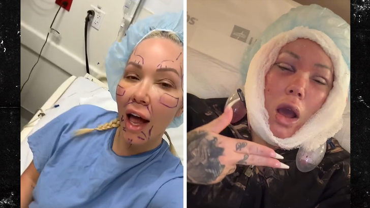 Remover 031626 Bunnie Xo Facelift