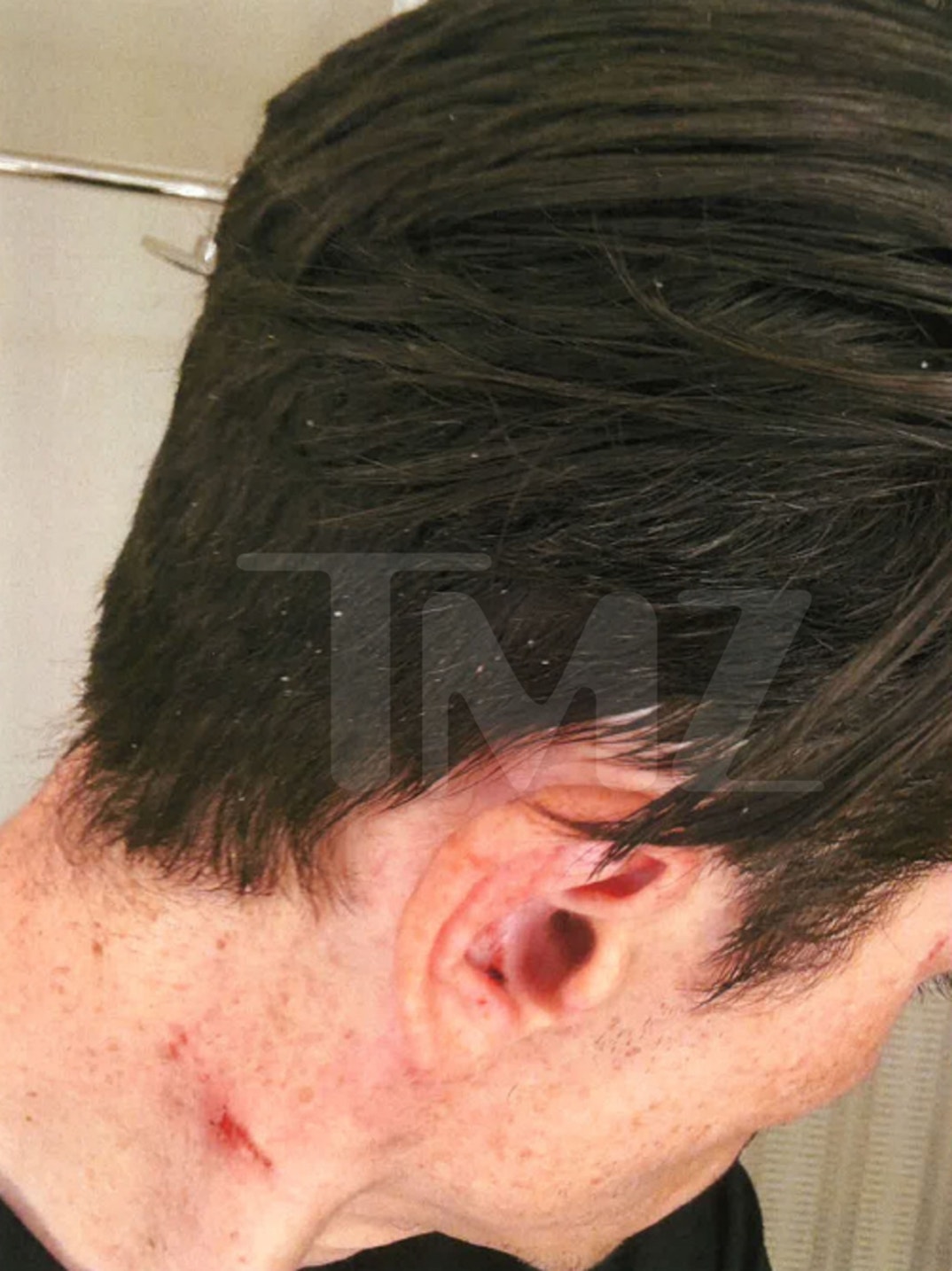 Tom Sandoval Injuries 0
