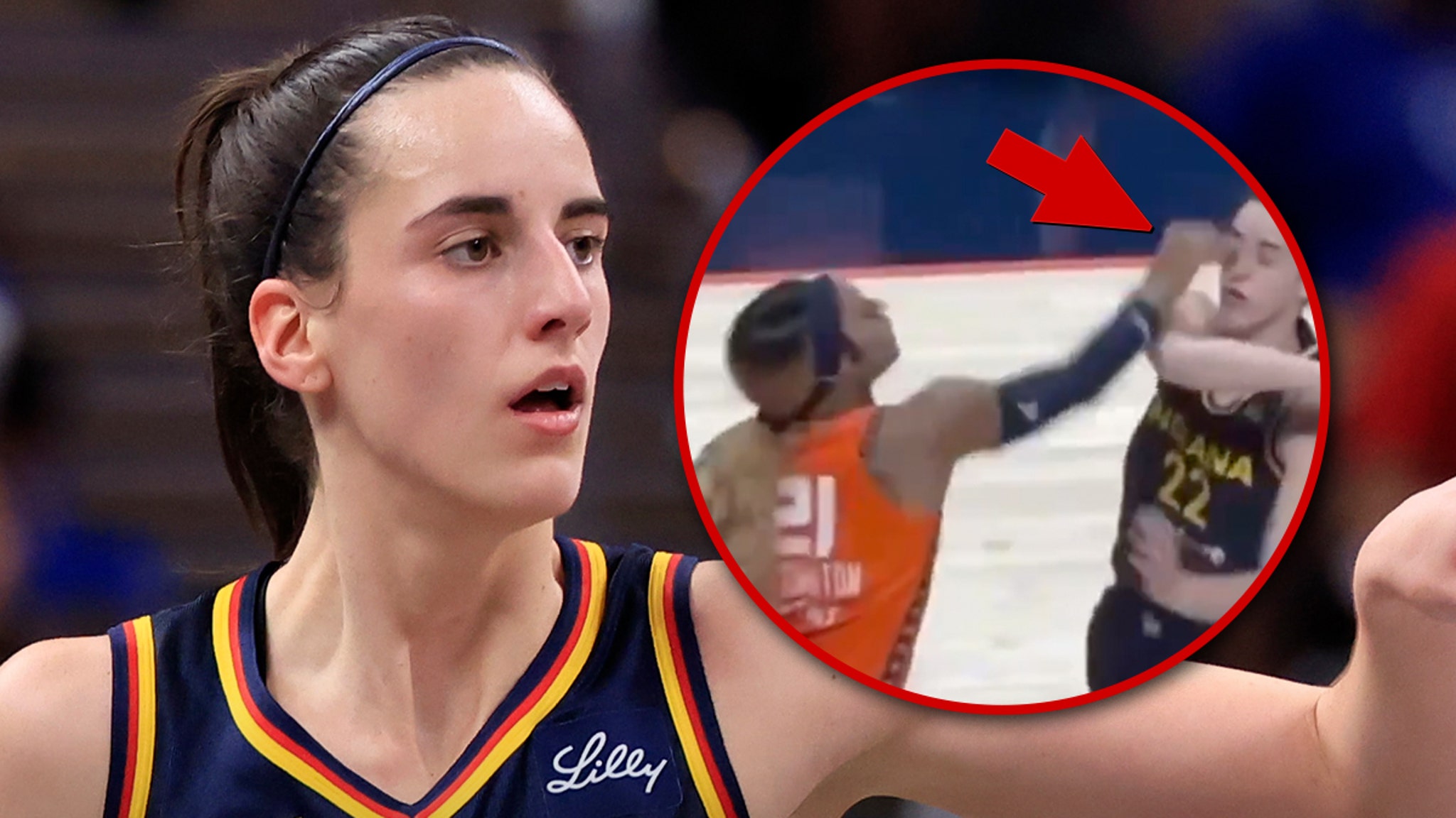 Caitlin Clark Suffers Bad Eye Poke During Game 1 Loss To Sun