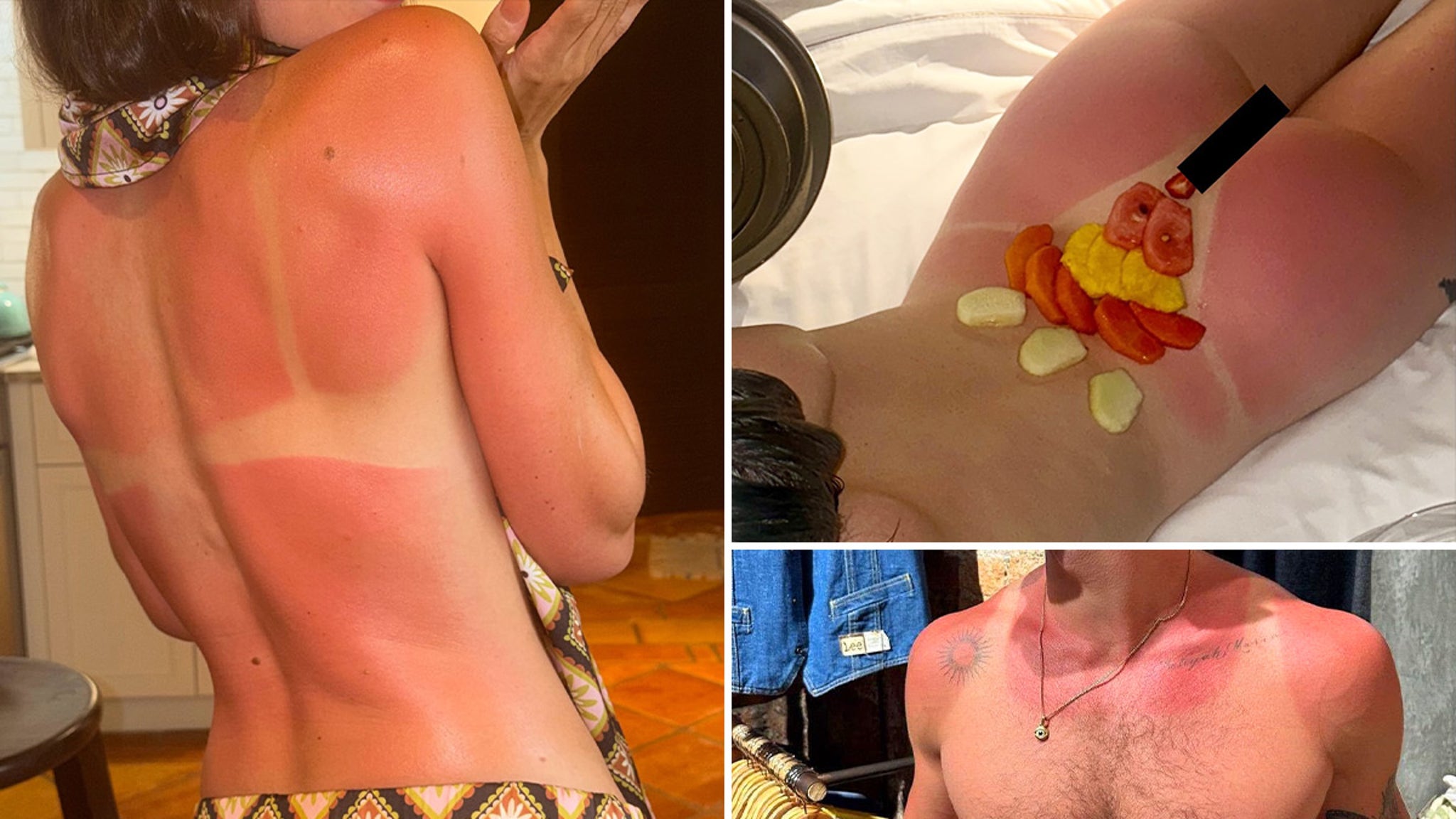 Celebrity Sunburns Guess Who!