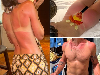 0730-Celebrity-Sunburns-Guess-Who-PRIMARY