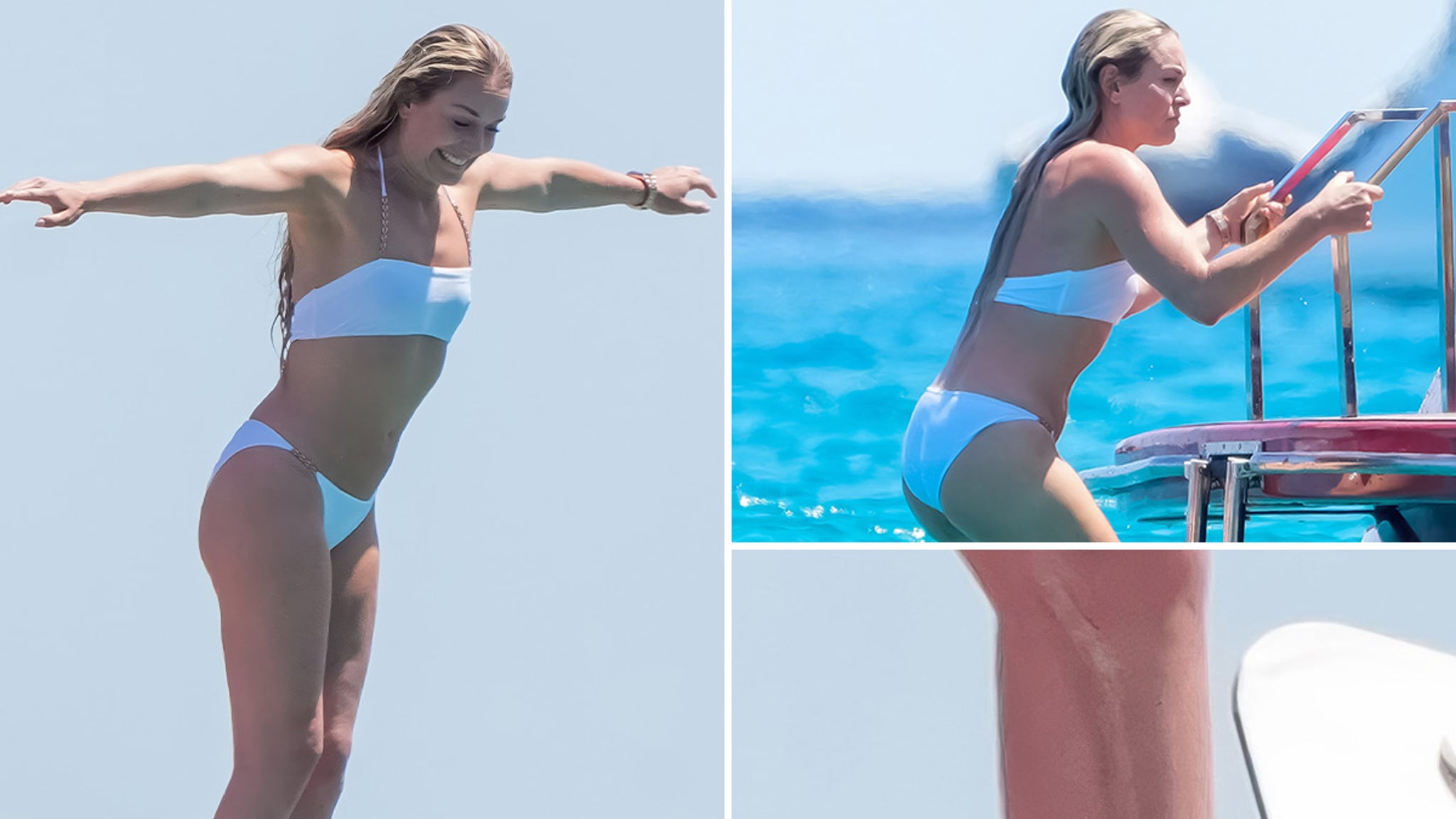 Lindsey Vonn Flaunts Killer Bikini Bod, Scars and All!