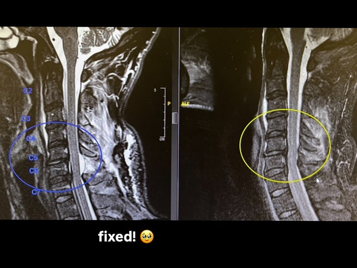 Nev Schulman suffers broken neck