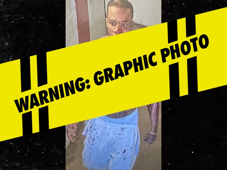 Tory Lanez Gruesome Photo