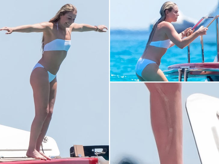 Lindsey Vonn Shows Off Bikini Bod Post Olympic Accident