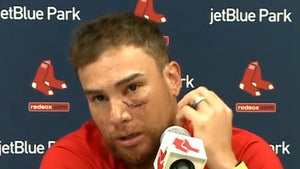 MLB's Christian Vazquez Shows Bloody Scar After Getting Drilled In Eye By Baseball