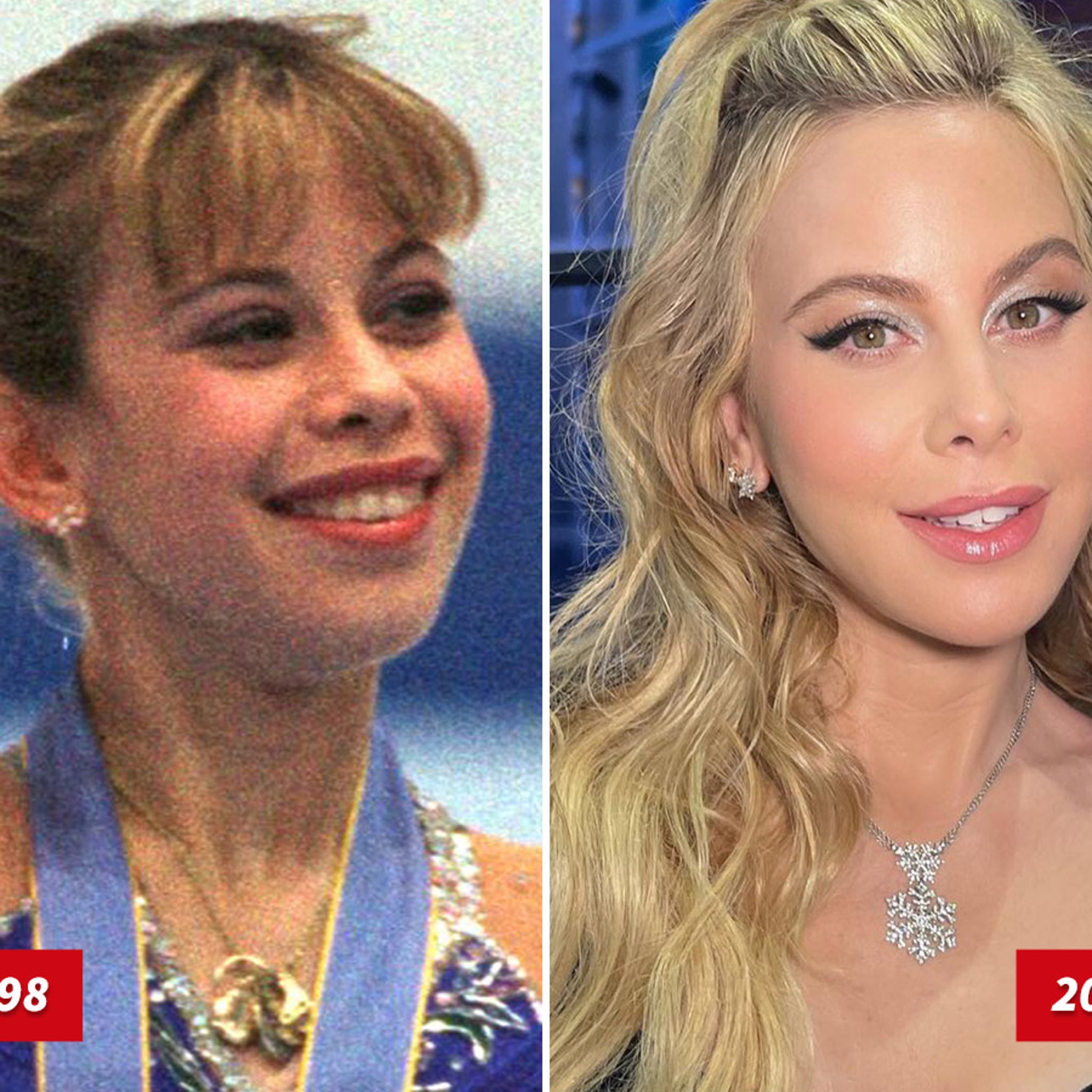Tara lipinski plastic surgery
