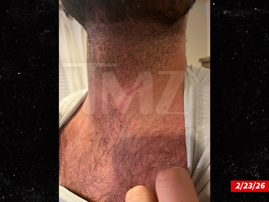 Dakota-Mortensen-Alleged-Injuries-Swipe- 3