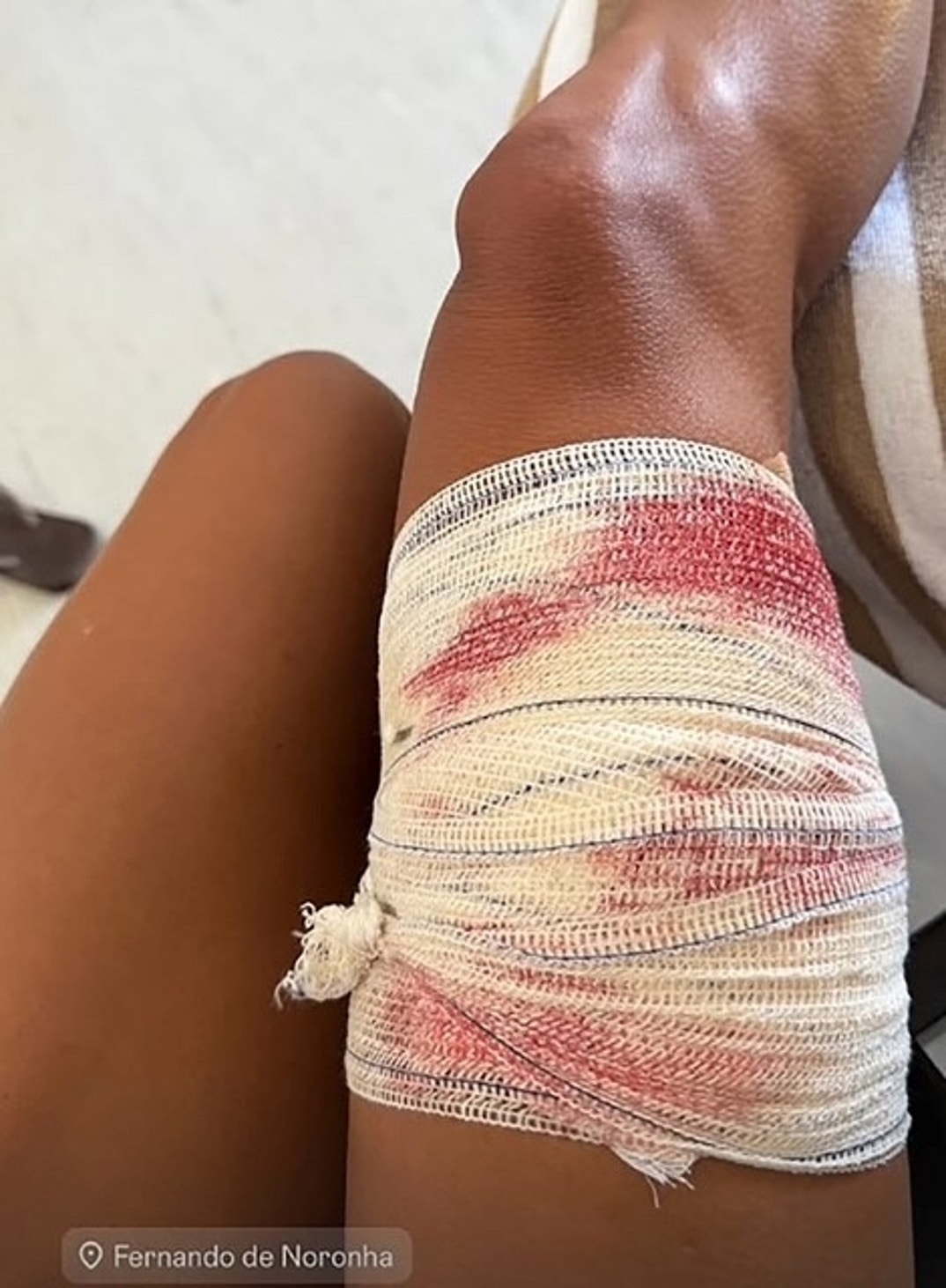 Lawyer Tayane Dalazen Shark Attack 0