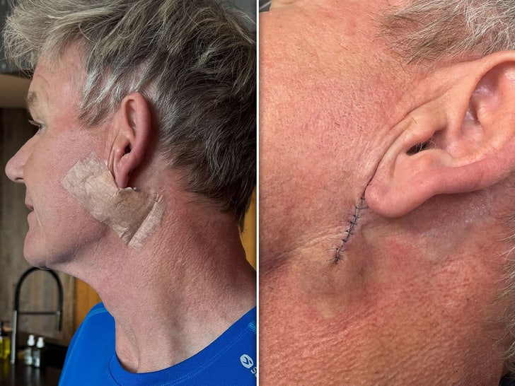 Gordon Ramsay Skin Cancer Instagram 3