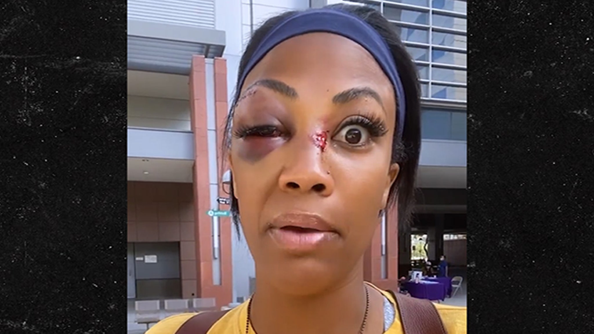 U.S. Olympian Kim Glass Attacked by Homeless Man In L.A., Gruesome Injuries