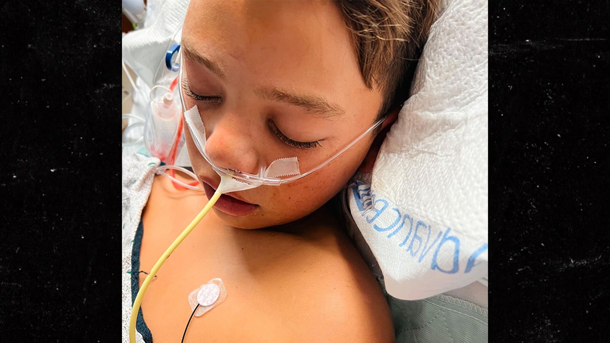 Little Leaguer Easton Oliverson's Breathing Tube Removed After Bunk Bed Fall