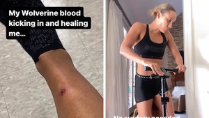 Lolo Jones Shows Gnarly Injury After Track Incident, See Bone Through Skin!