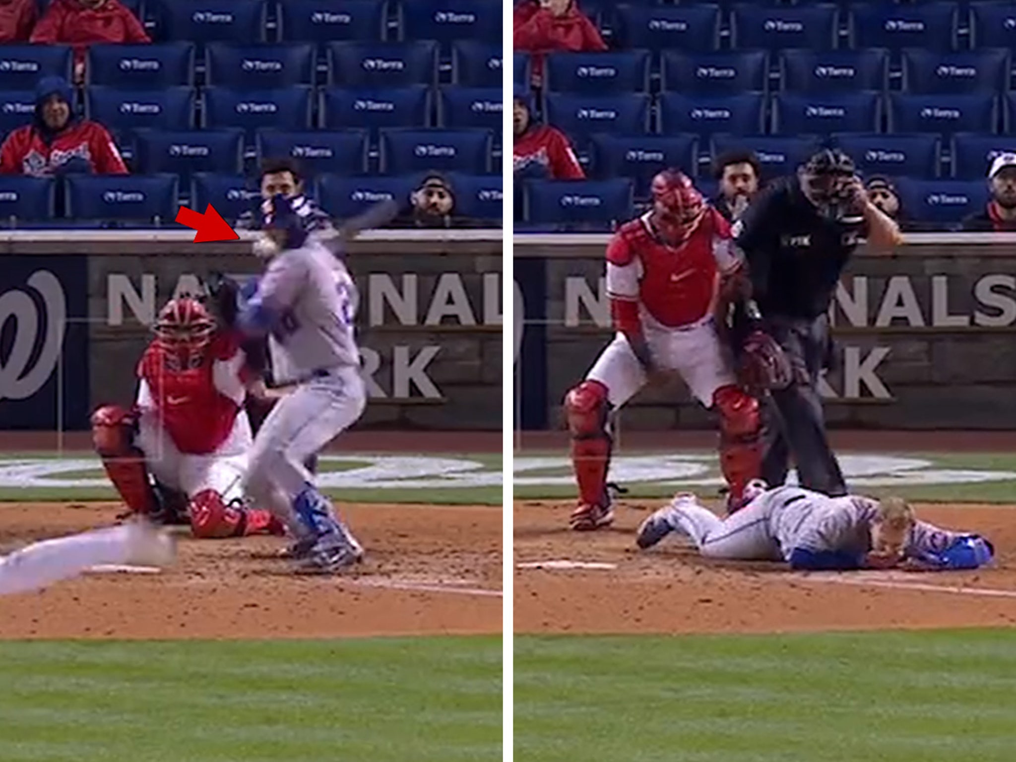 Mets Star Pete Alonso Drilled In Face By 95 MPH Fastball