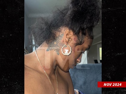 kylie frost alleged injuries by t hood tmz 2