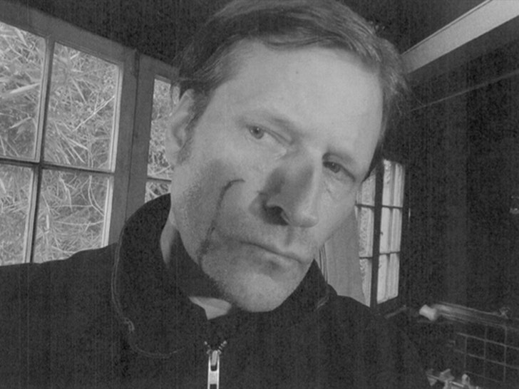 『バック・トゥ・ザ・フューチャー』のクリスピン・グローバー、写真は元彼にひどく殴られたことを証明していると語る