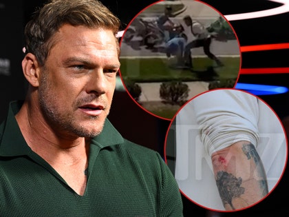 alan ritchson fight and injury getty tmz