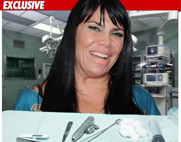renee mob graziano wives tmz surgery ass son wife nervous says she lift didn plastic quot tuck tummy procedure gave