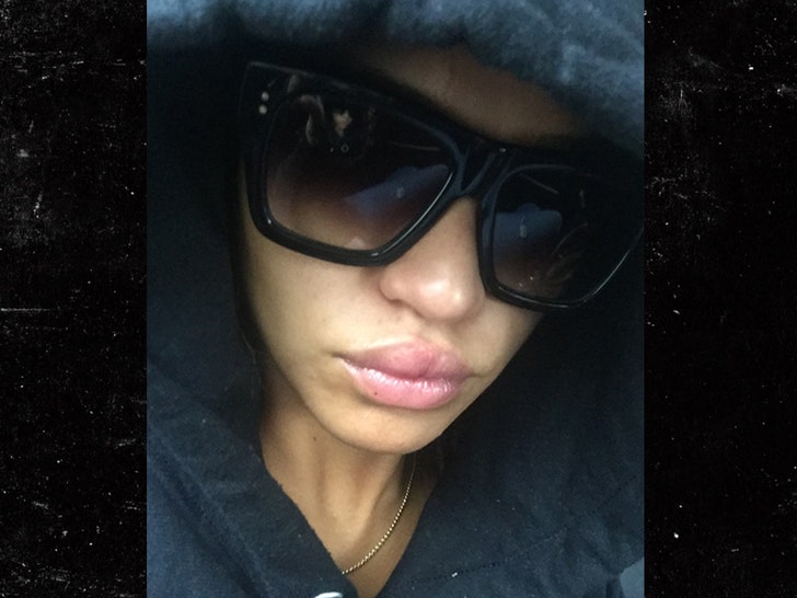 cassie fat lip