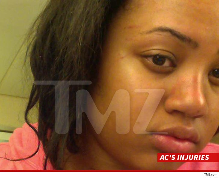 Bad Girls Club' Judi Jai -- Booted from Cruise After :: 0916-sub-ac-injuries-tmz-4