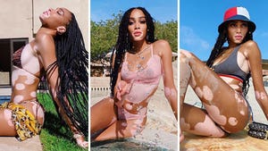 Winnie Harlow's Quarantine Hot Shots