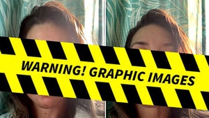 Evangeline Lilly injuries warning launch instagram
