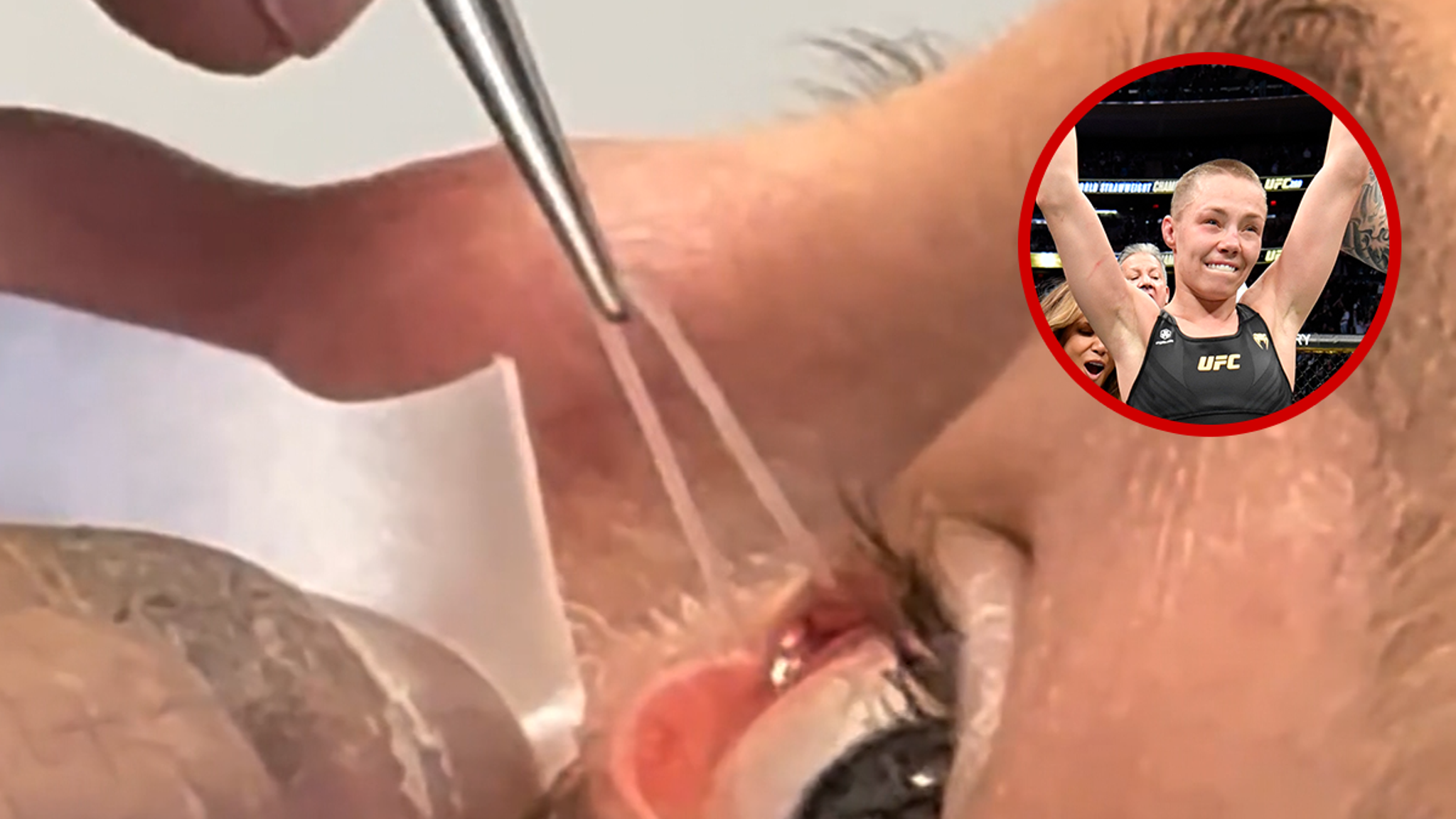 UFC's Rose Namajunas Shares Gruesome Footage of Silicone Tube Removal From Eye