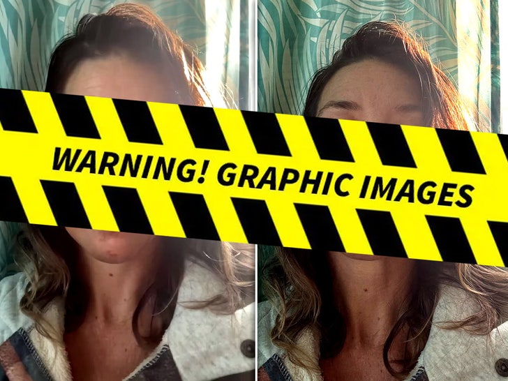 Evangeline Lilly's Fall Injury