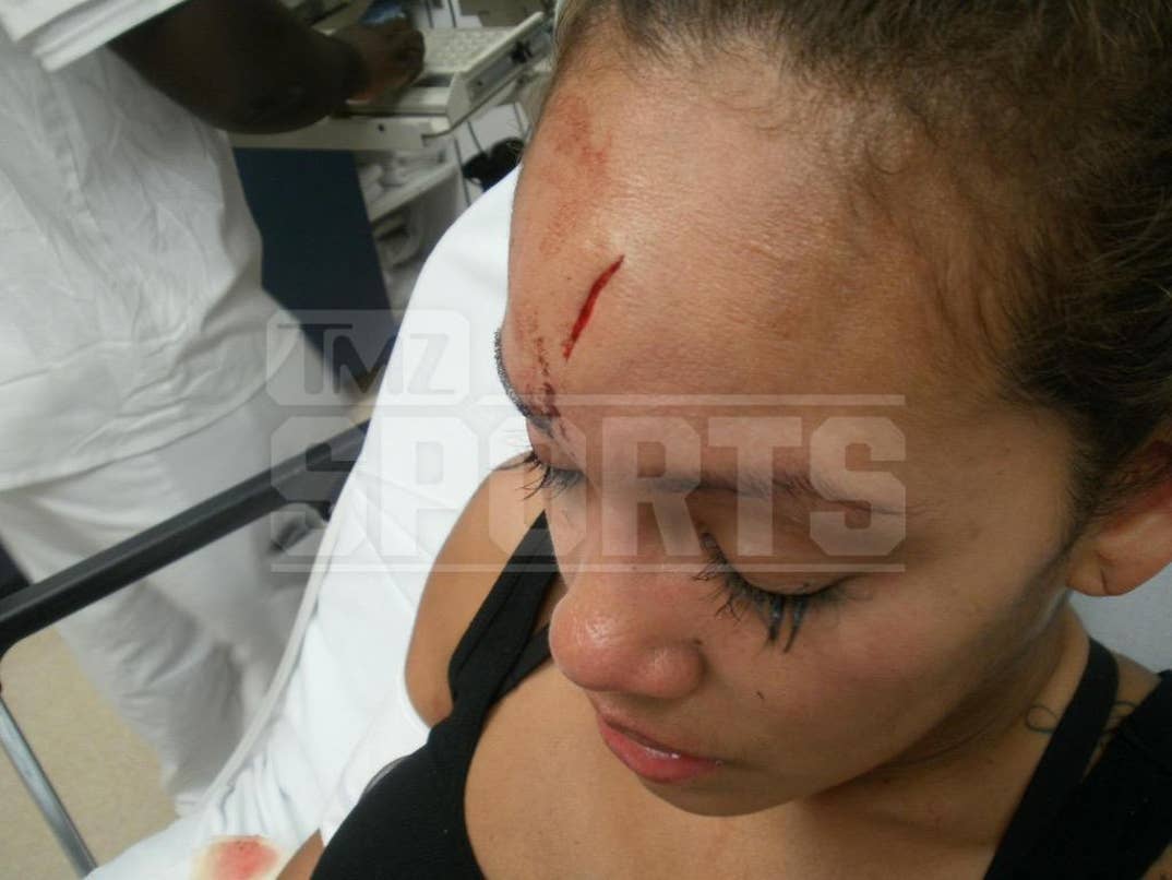 Evelyn Lozada's Head Injury, image size:1074x806