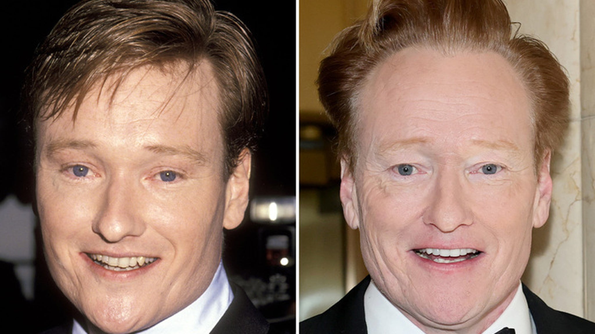 Conan O'Brien -- Good Genes or Good Docs?!