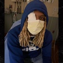 Lil Durk Announces He's Taking Time Off After Suffering Injury in Explosion