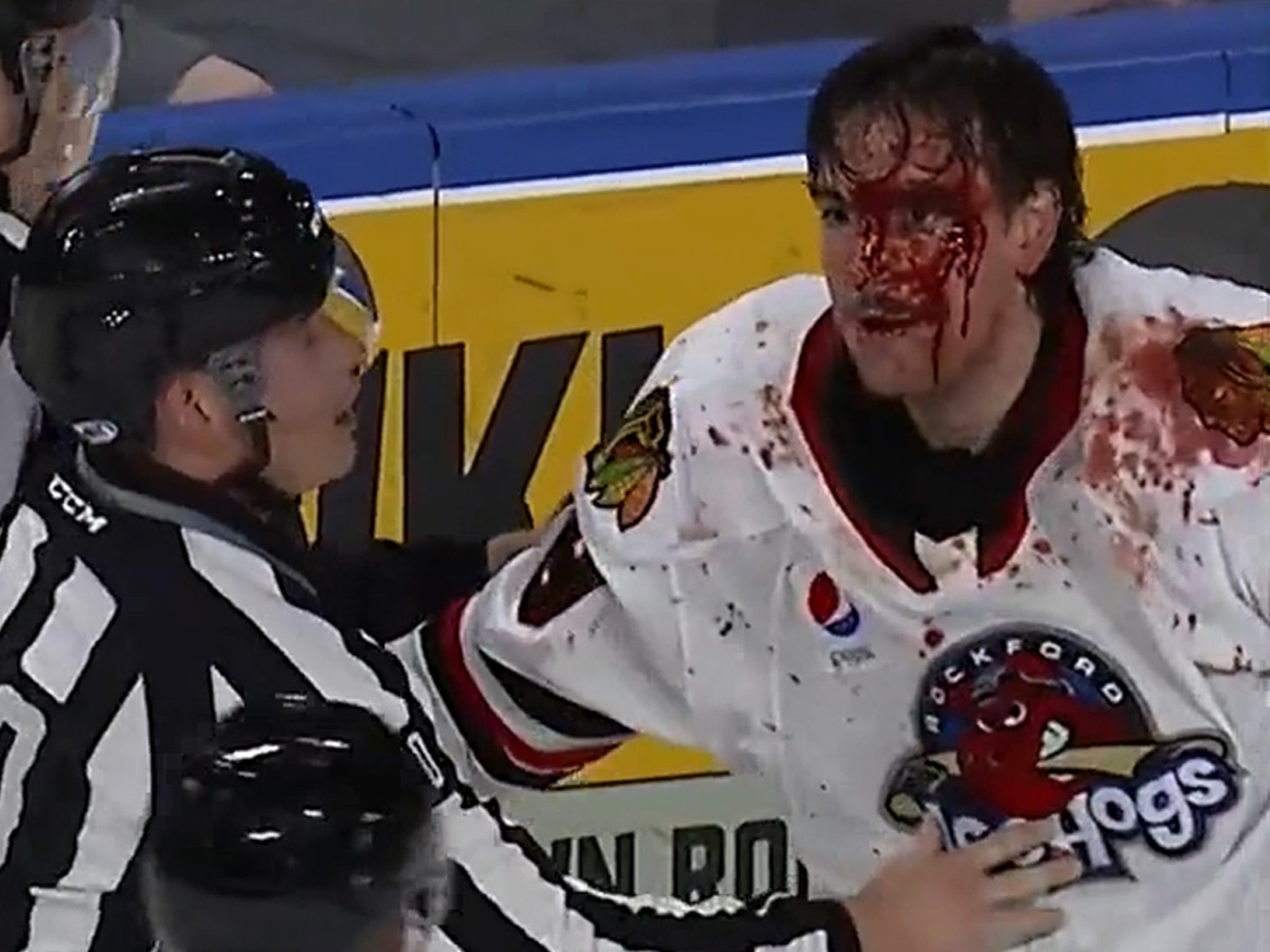 Minor League Hockey Player Left A Bloody Mess After Violent On-Ice Fight