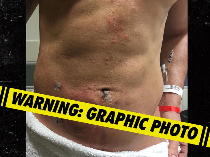 Joe Manganiello Recovery Photo