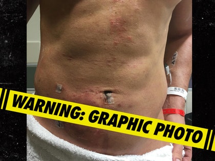 JOE MANGANIELLO hospital pics 2 censor
