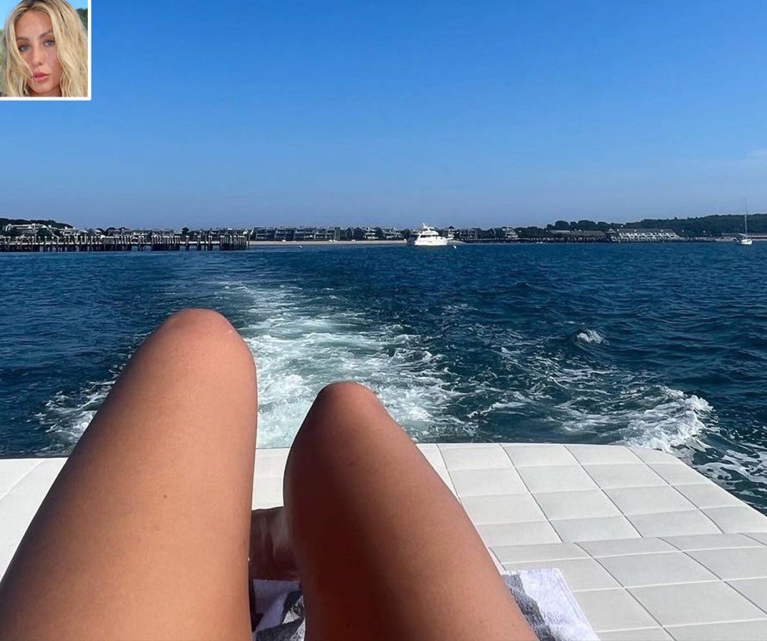 Celebrity Hot Dog Legs -- Guess Who!