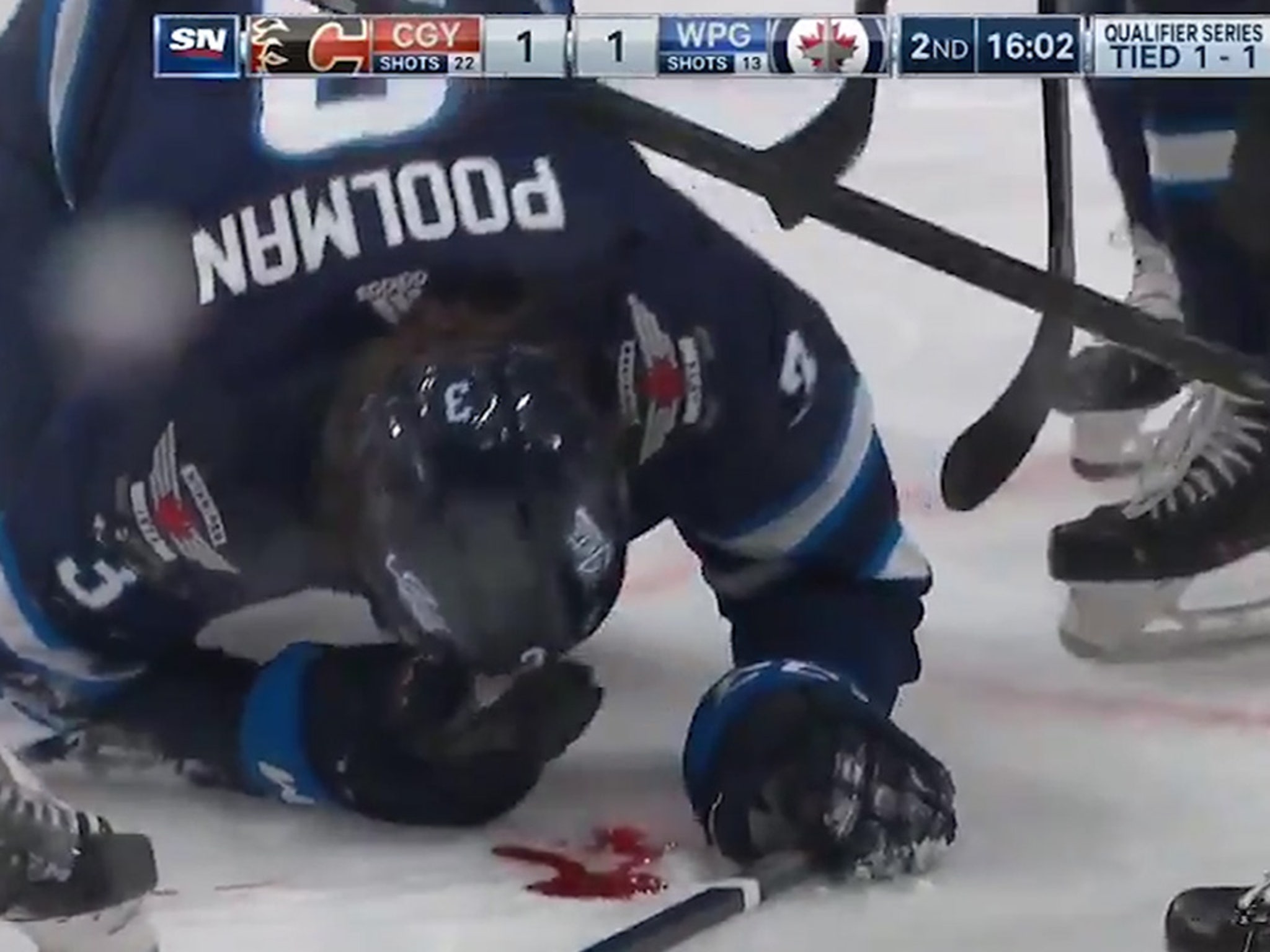 nhl puck in face