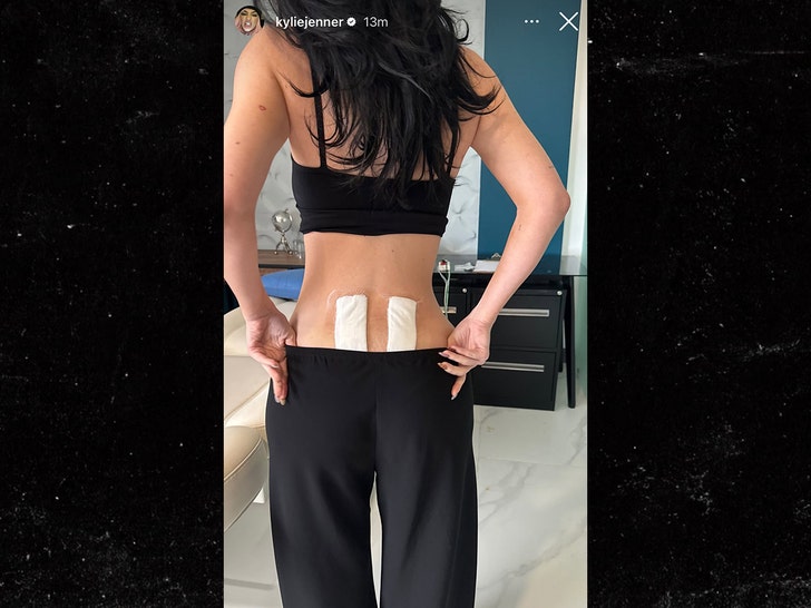 kylie jenner stem cell therapy insta 2
