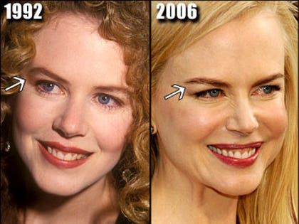 n_kidman_365x290